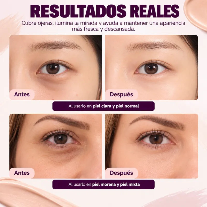 Dr. Melaxin Calcium™ – Crema Correctora de Ojeras